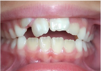 Before treatment